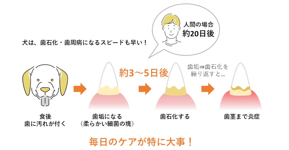 歯垢の付着から歯石化までのサイクル