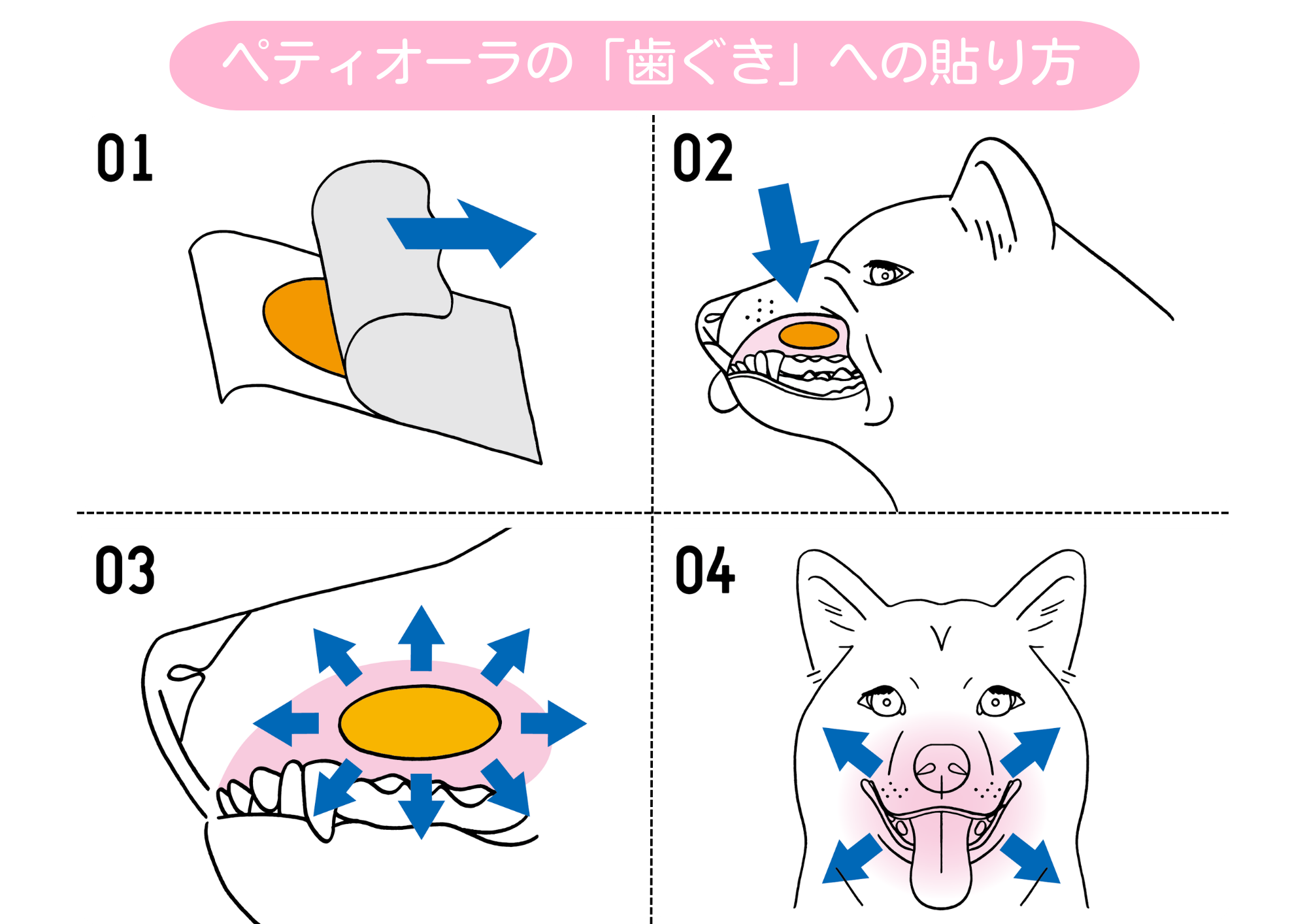 ペティオーラの歯茎への貼り方